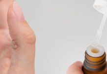 Warzen Hausmittel Teebaumöl Behandlung