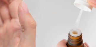 Warzen Hausmittel Teebaumöl Behandlung