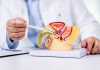 Prostata Diagnose Behandlung Symptome
